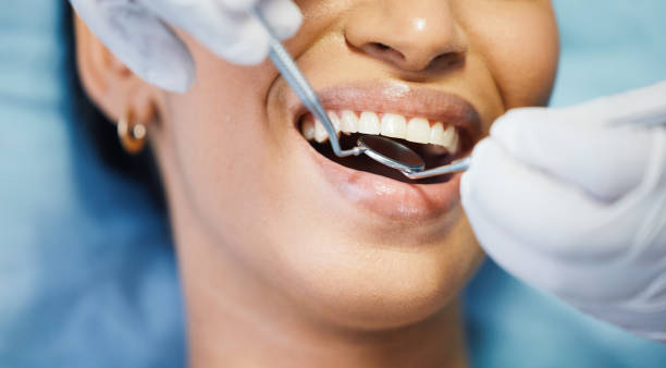 Best Emergency Treatment for Dental Infections or Abscesses in Broad Creek, NC